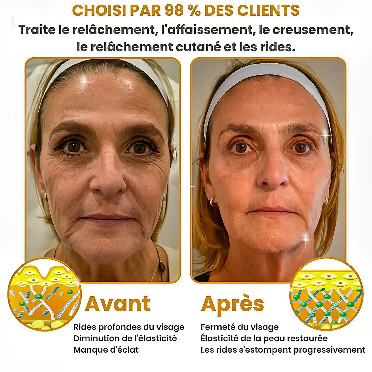 BOTOX- Réduisez les Rides en 2 Minutes - Sérum Anti-Âge Rapide et Efficace - Économisez Temps et Argent
